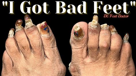 disgusting feet photos